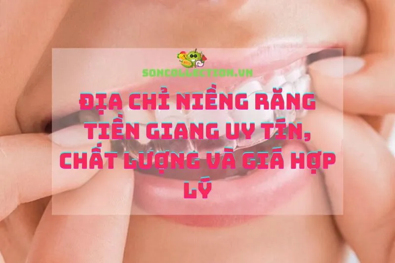 Địa chỉ niềng răng Tiền Giang uy tín, chất lượng và giá hợp lý